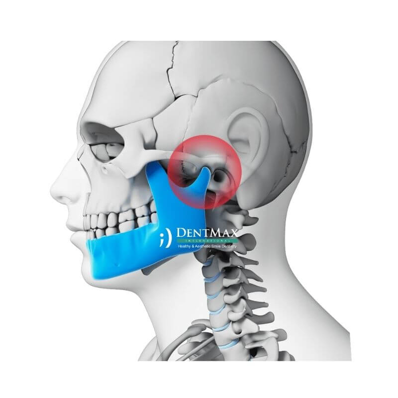 Dentmax