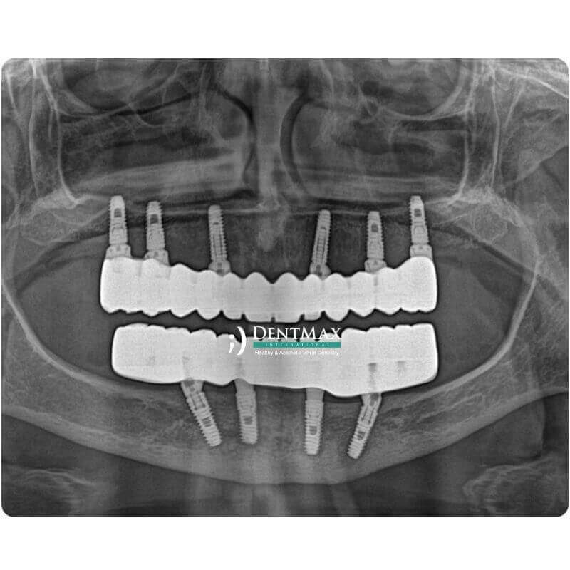 Dentmax Banner