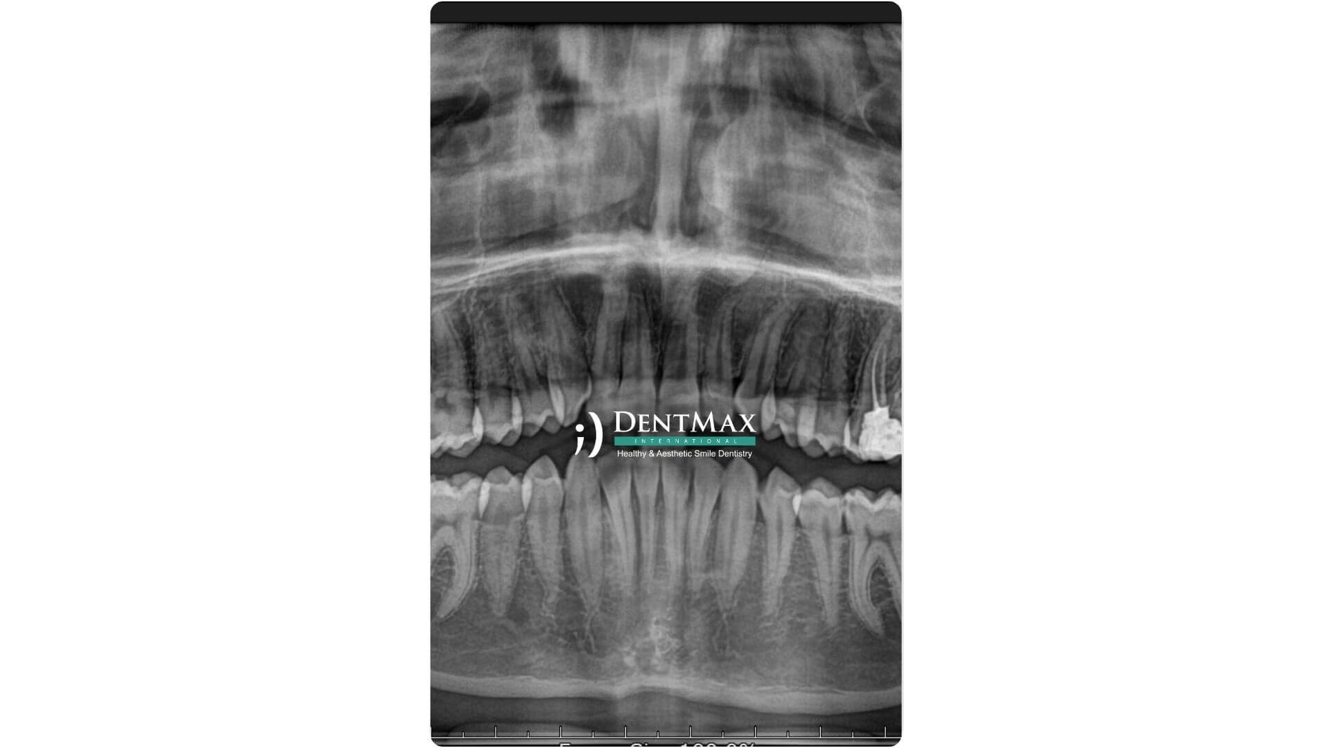 Dentmax Banner
